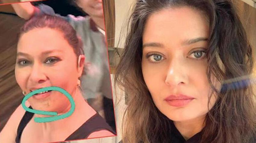 Nurgül Yeşilçay sette kaza yaptı! 'Fren yerine gaza basmış'