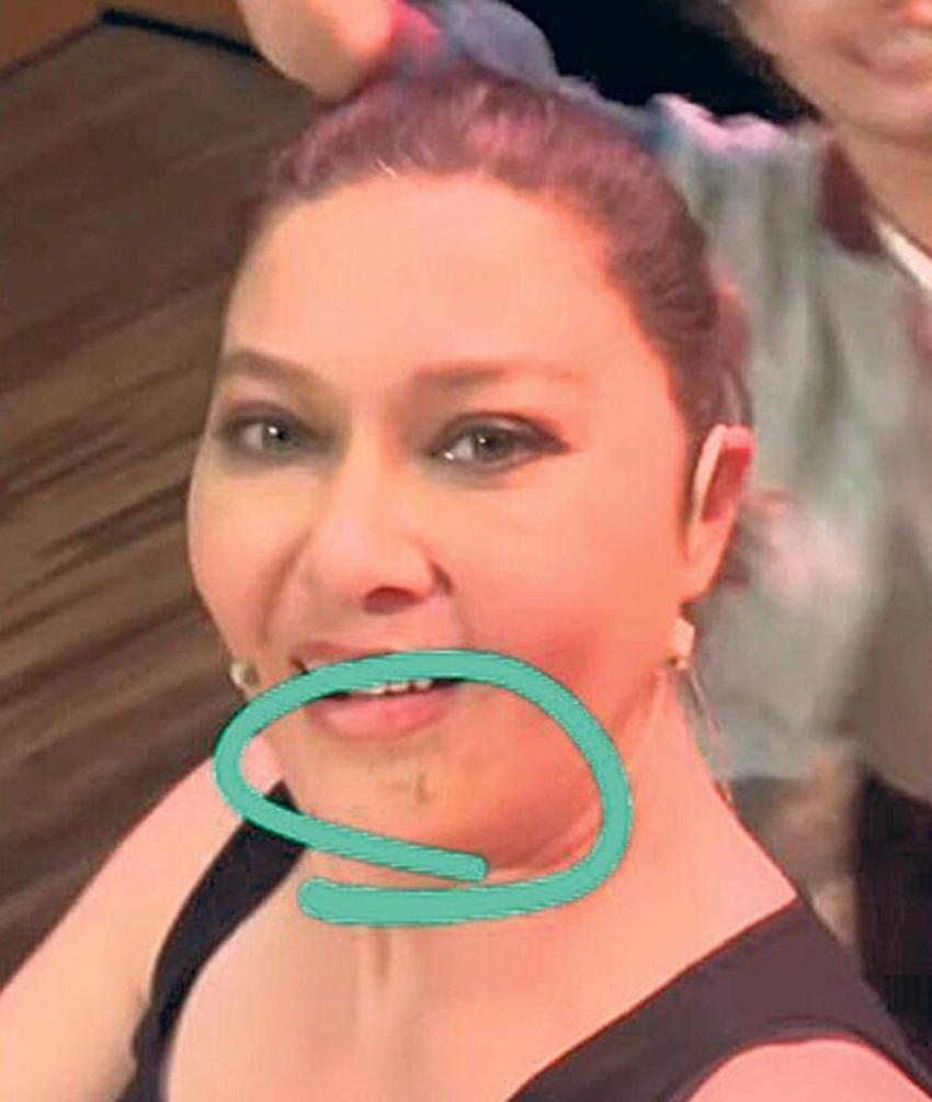 Nurgül Yeşilçay sette kaza yaptı! 'Fren yerine gaza basmış'
