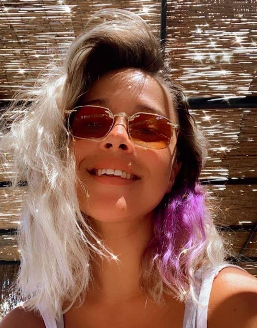 Selami Şahin'in kızı Meryem İrem Şahin de estetikliymiş!