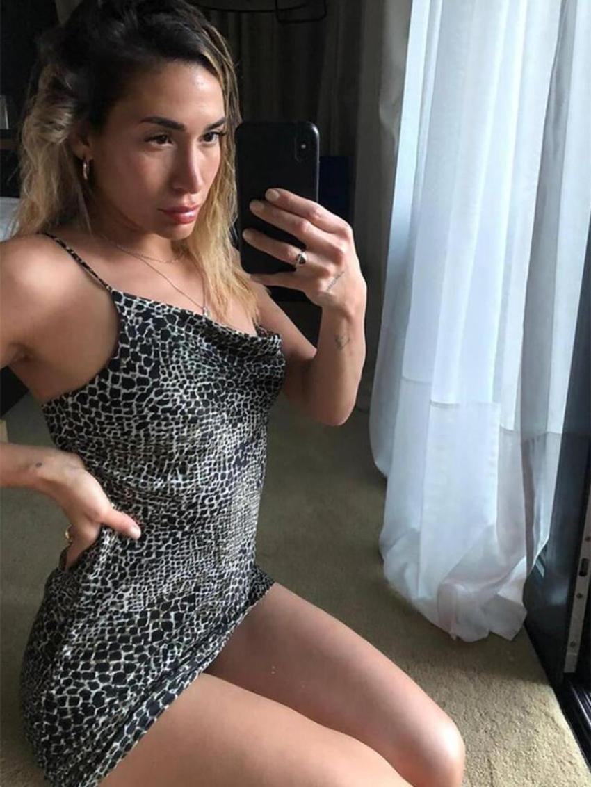 Survivor Berna Canbeldek'in son halini gören şaşırıyor!