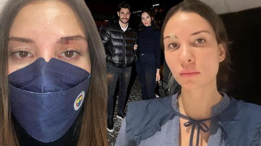 Mihriban Hurmacı'dan şiddet açıklaması: Özer Hurmacı çocuklarımın önünde beni dövdü