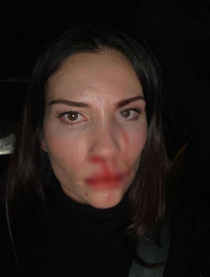 Mihriban Hurmacı'dan şiddet açıklaması: Özer Hurmacı çocuklarımın önünde beni dövdü
