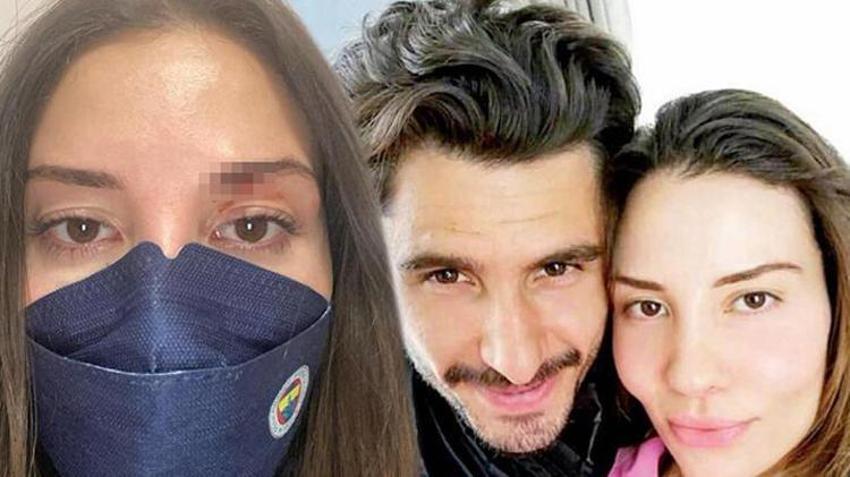 Mihriban Hurmacı: Özer beni kendisine muhtaç etti!