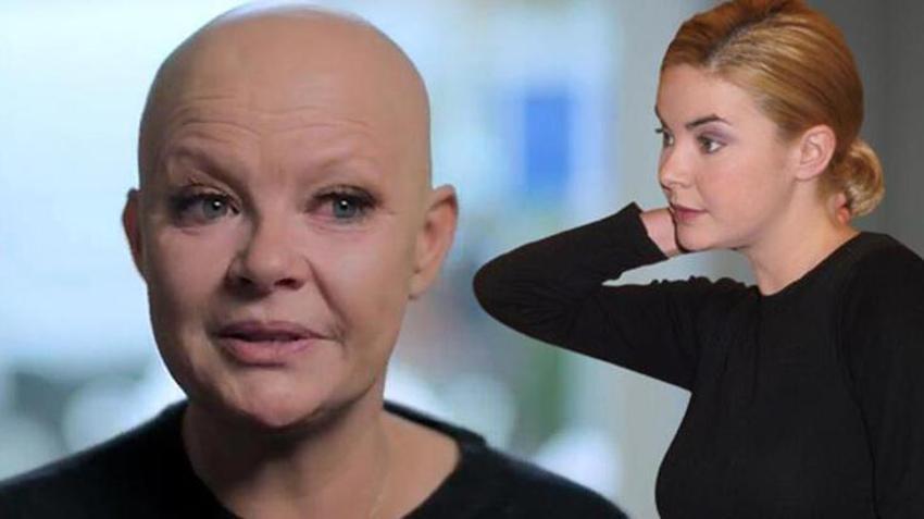 Dünyaca ünlü isim Gail Porter'dan kötü haber! "Beni hiçbir şey yıkamaz"