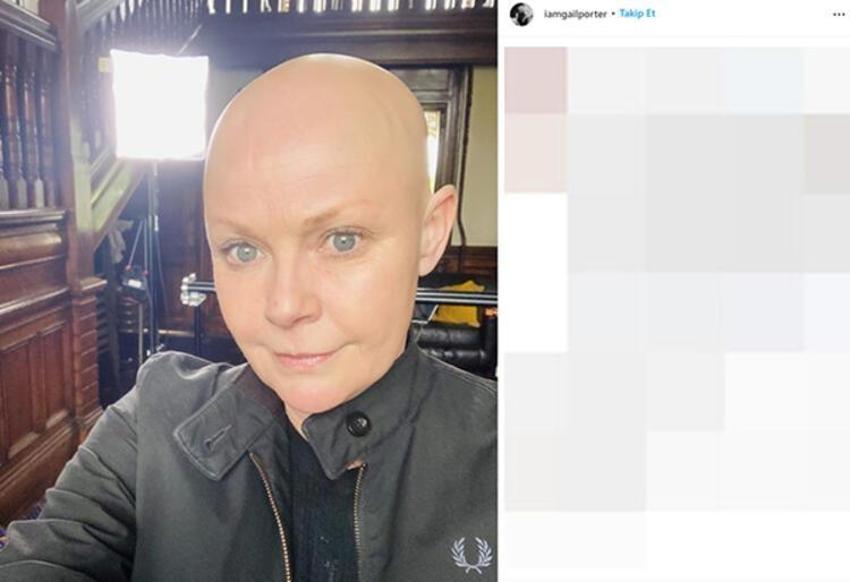 Dünyaca ünlü isim Gail Porter'dan kötü haber! "Beni hiçbir şey yıkamaz"