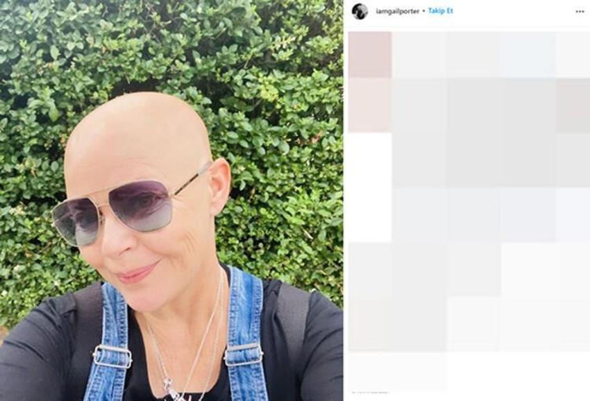 Dünyaca ünlü isim Gail Porter'dan kötü haber! "Beni hiçbir şey yıkamaz"