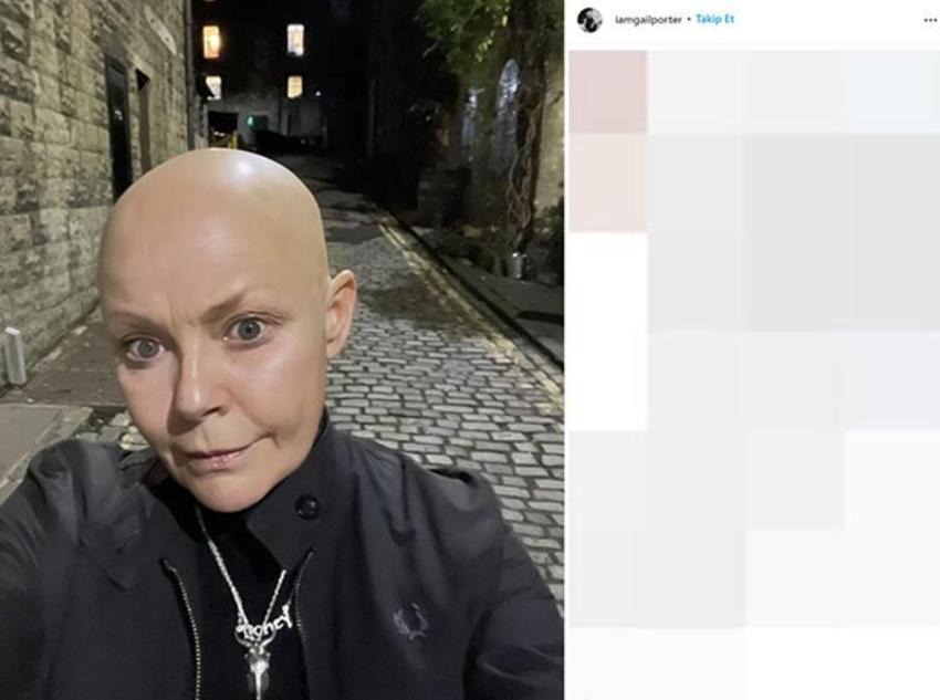 Dünyaca ünlü isim Gail Porter'dan kötü haber! "Beni hiçbir şey yıkamaz"