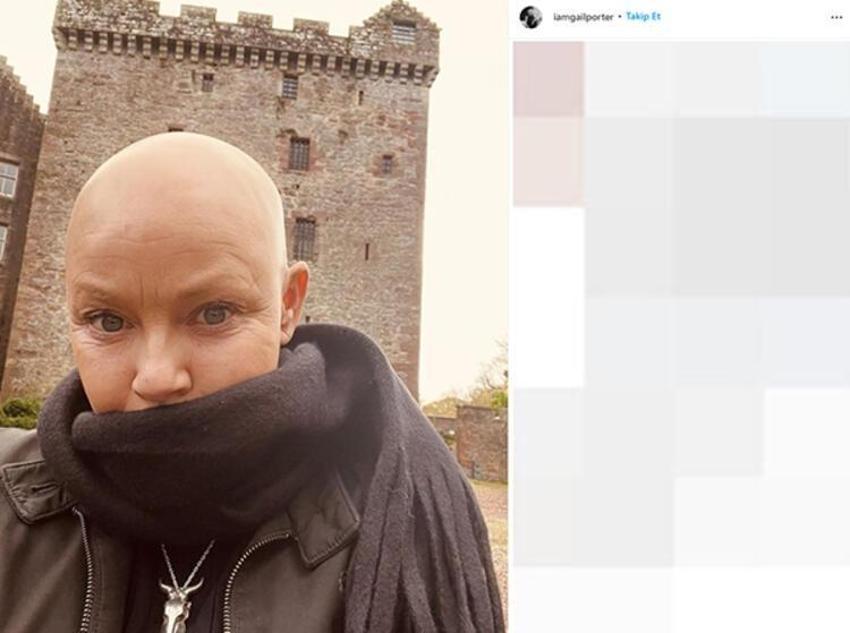 Dünyaca ünlü isim Gail Porter'dan kötü haber! "Beni hiçbir şey yıkamaz"