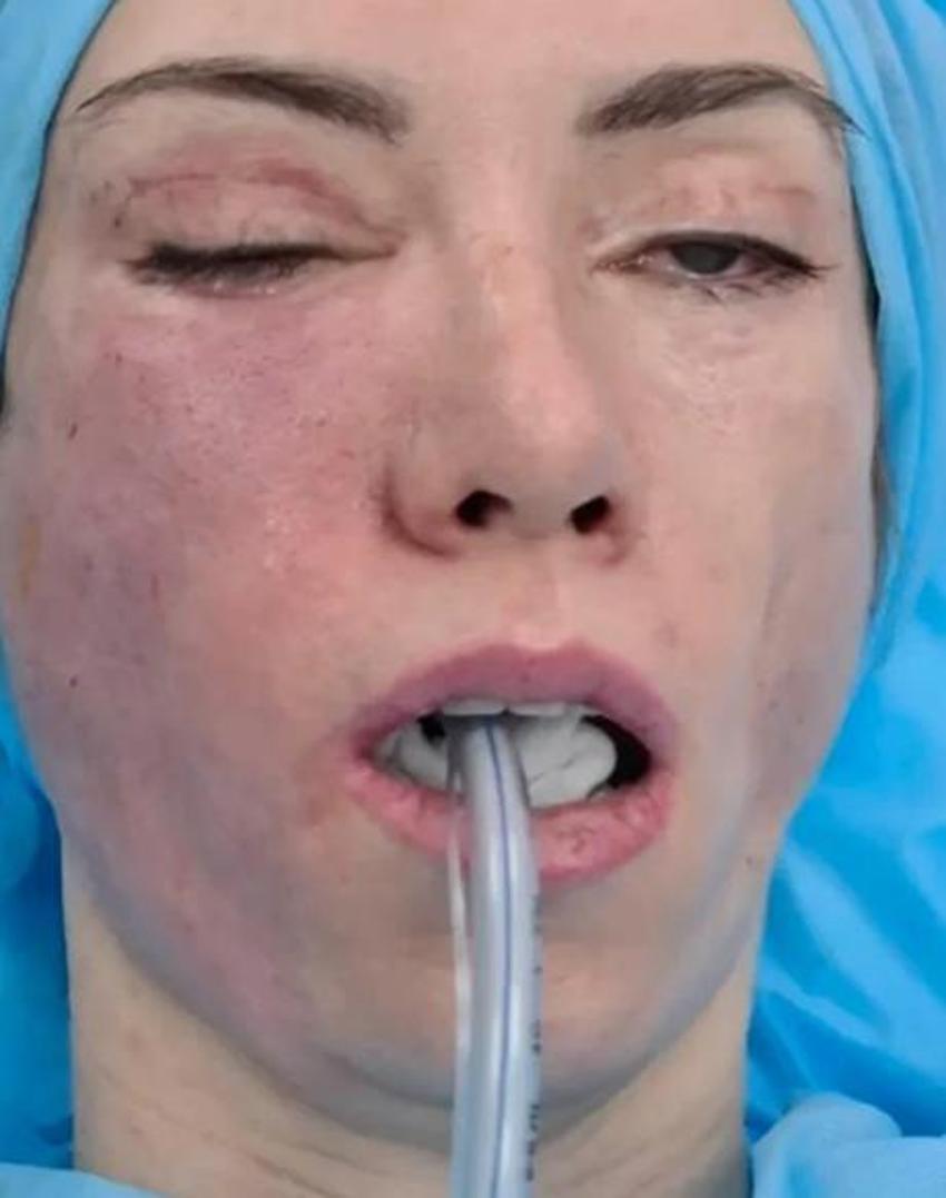 Rus güzellik kraliçesi Yulia Tarasevich’in hayatı kabus oldu! Estetik faciası...