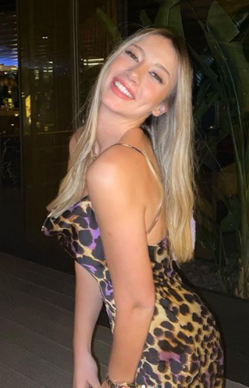 Survivor Aleyna Kalaycıoğlu estetik sorusunu duyunca...