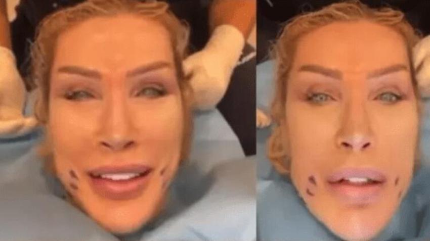 Seda Sayan soluğu estetik doktorunda aldı! O anları canlı canlı yayınladı...