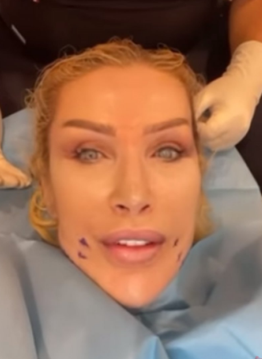 Seda Sayan soluğu estetik doktorunda aldı! O anları canlı canlı yayınladı...