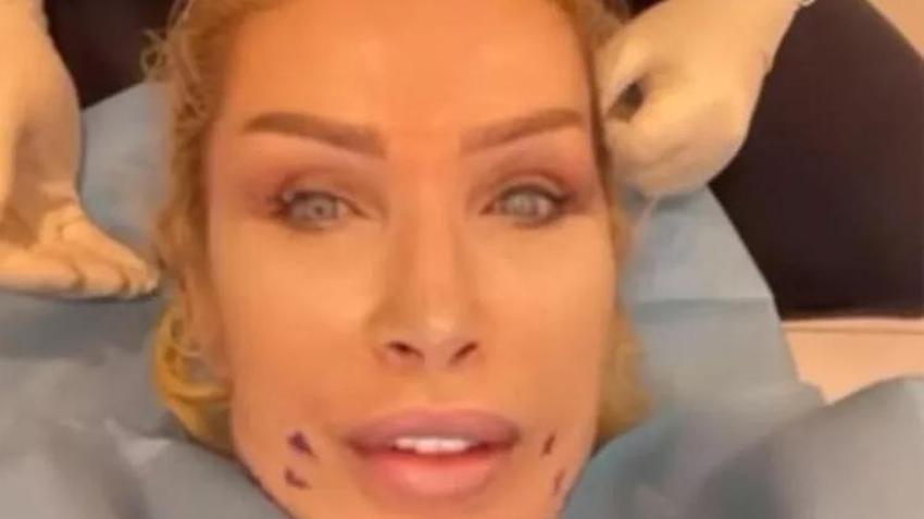 Seda Sayan soluğu estetik doktorunda aldı! O anları canlı canlı yayınladı...