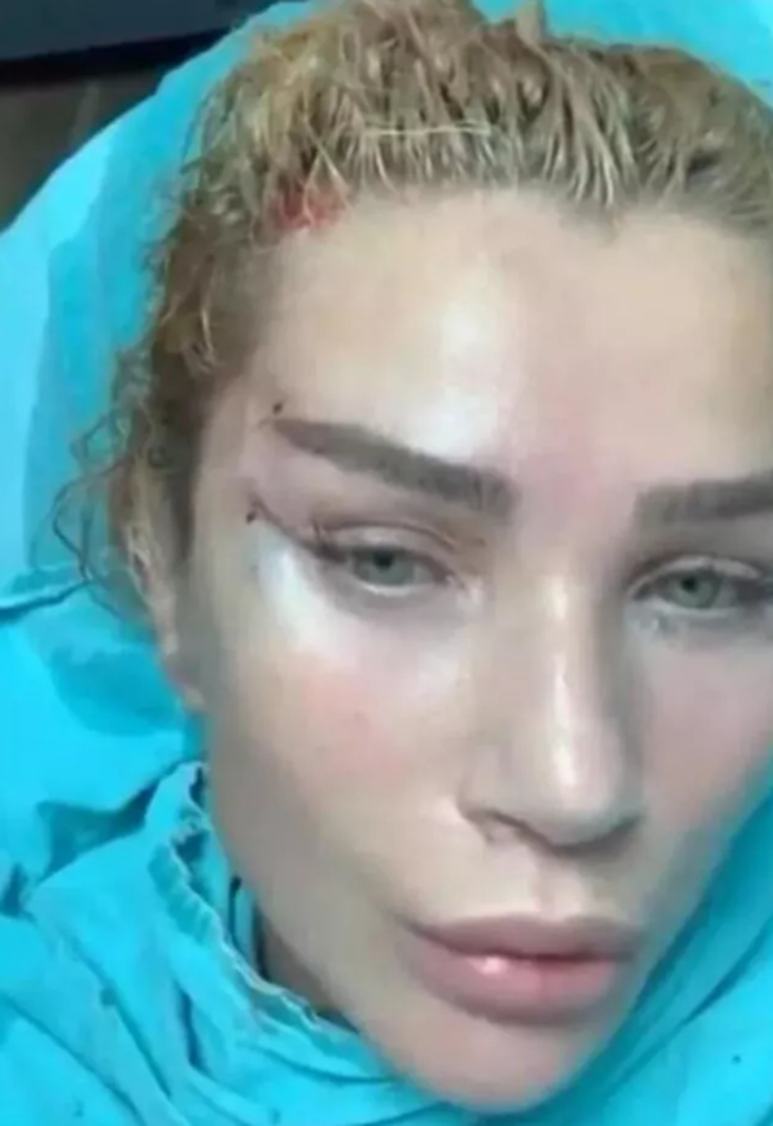 Seda Sayan soluğu estetik doktorunda aldı! O anları canlı canlı yayınladı...