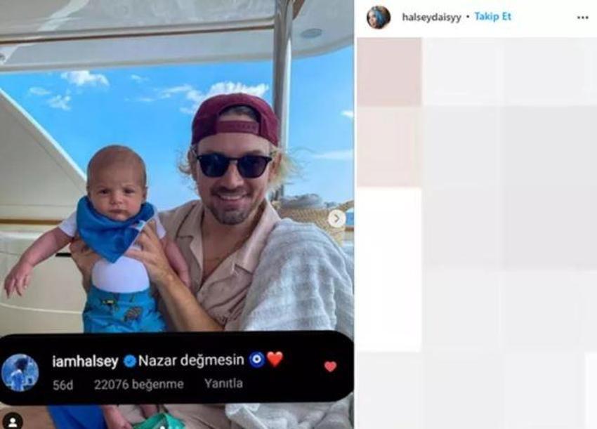 Dünyaca ünlü şarkıcı Halsey ameliyat oldu! 'Kırılganım ama heyecanlıyım'