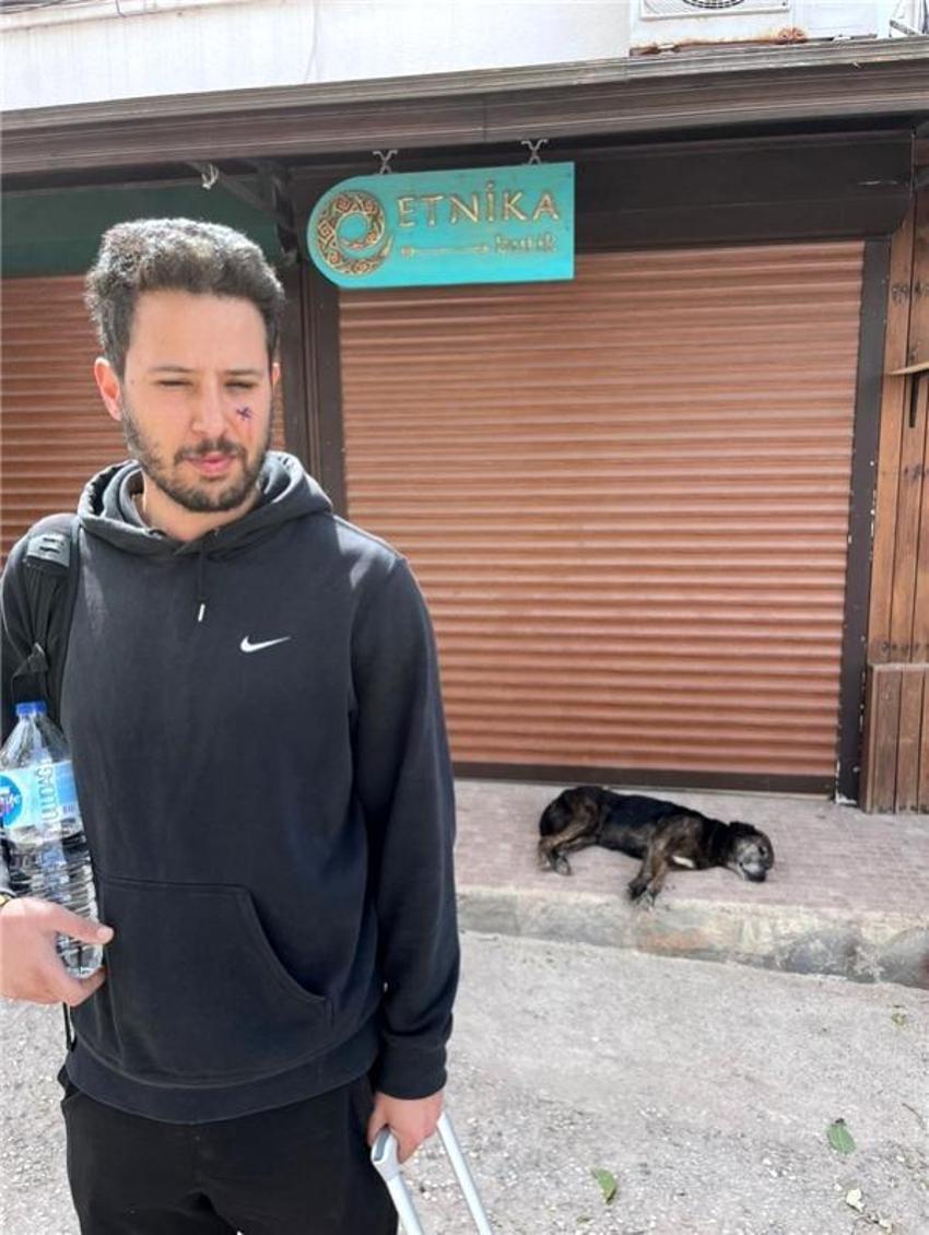 Tuan Tunalı neredeyse gözünden oluyordu! Köpek ısırdı