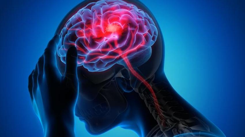 Beyni erken yaşlandırıyor, bu 6 belirtiye dikkat! Alzheimer hastalığı ile...