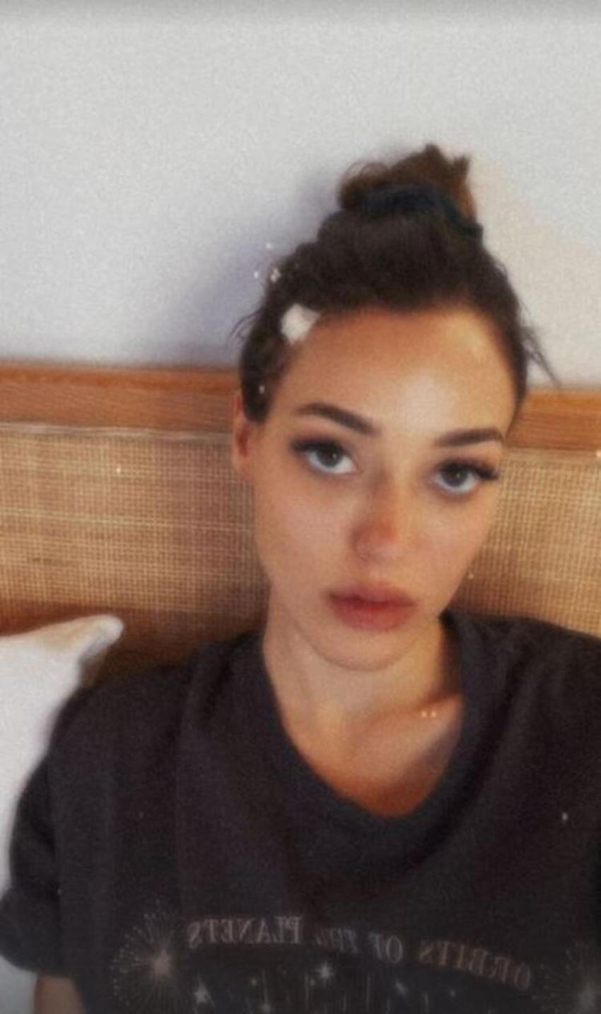 Dilan Çiçek Deniz sette kaza geçirdi! Sağlık durumu...