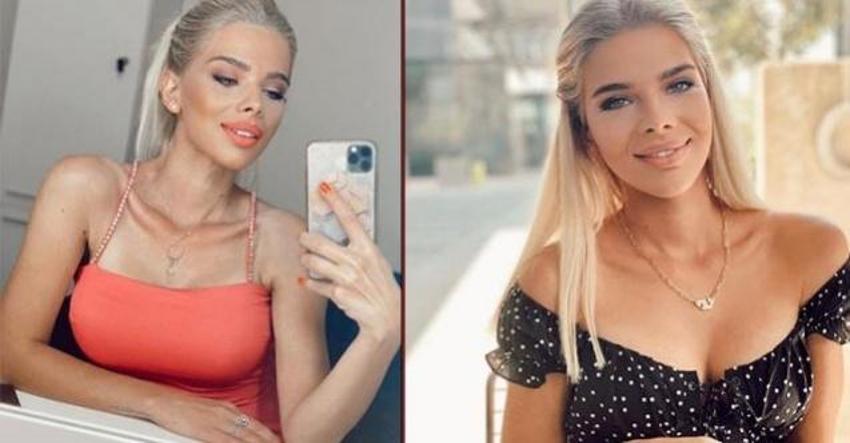 Sihirli Annem'in Tuğçe'si Damla Ersubaşı'dan estetik itirafı!