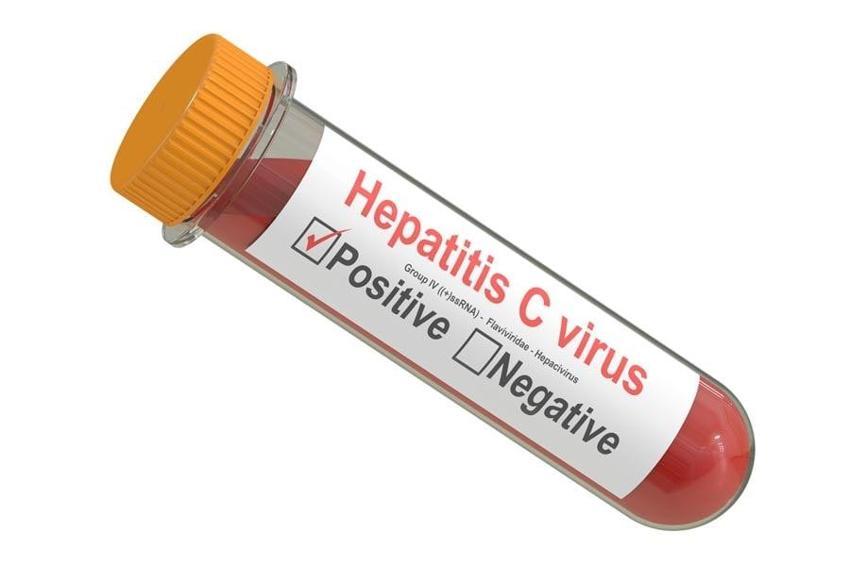 Dünya şaşkın! Gizemli Hepatit virüsü Avrupa ve ABD'de yayılmaya başladı, ülkeler alarmda...