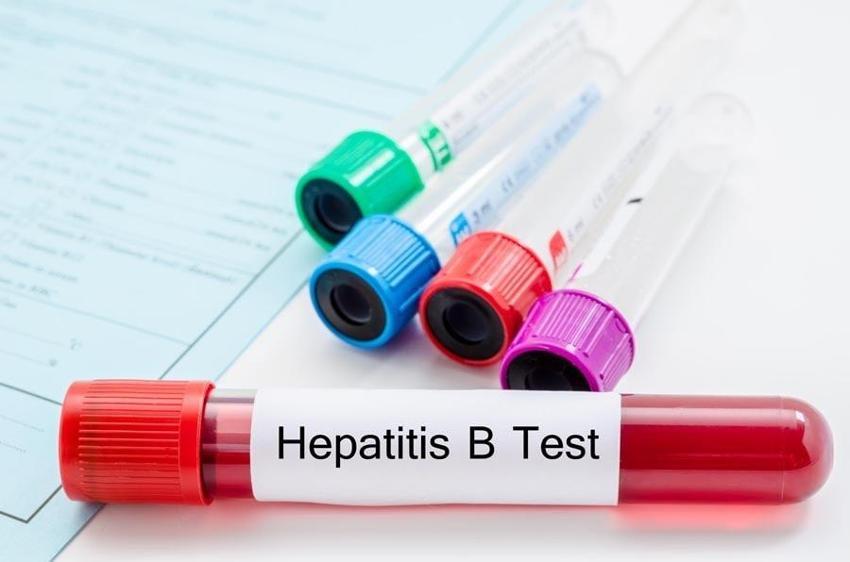 Dünya şaşkın! Gizemli Hepatit virüsü Avrupa ve ABD'de yayılmaya başladı, ülkeler alarmda...