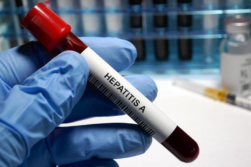 Dünya şaşkın! Gizemli Hepatit virüsü Avrupa ve ABD'de yayılmaya başladı, ülkeler alarmda...