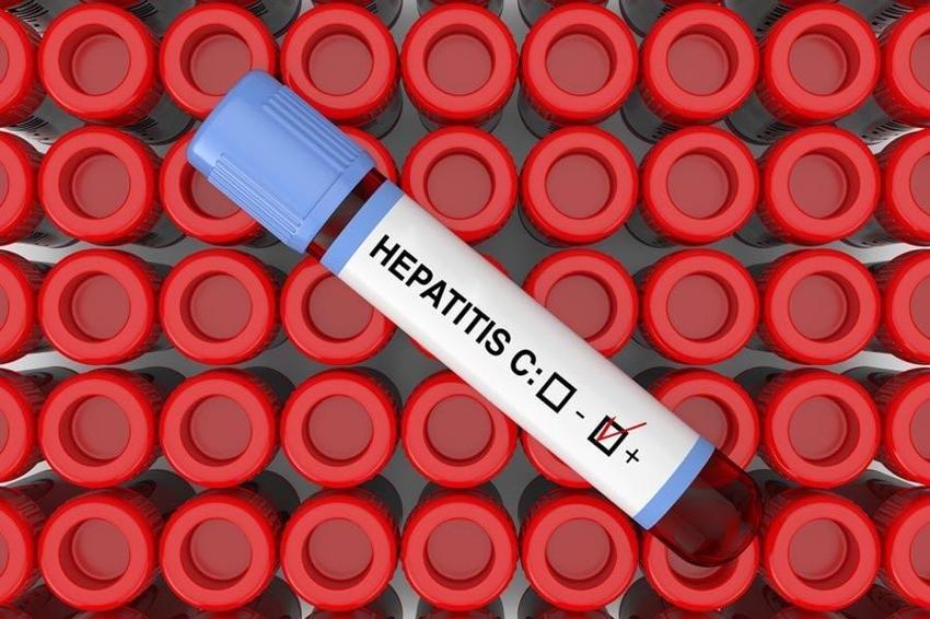 Dünya şaşkın! Gizemli Hepatit virüsü Avrupa ve ABD'de yayılmaya başladı, ülkeler alarmda...