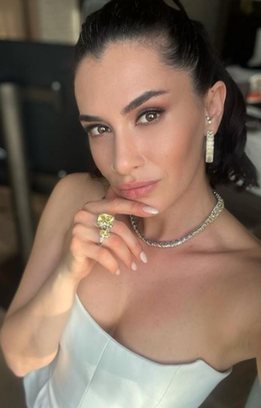 Hande Doğandemir'den estetik açıklaması!