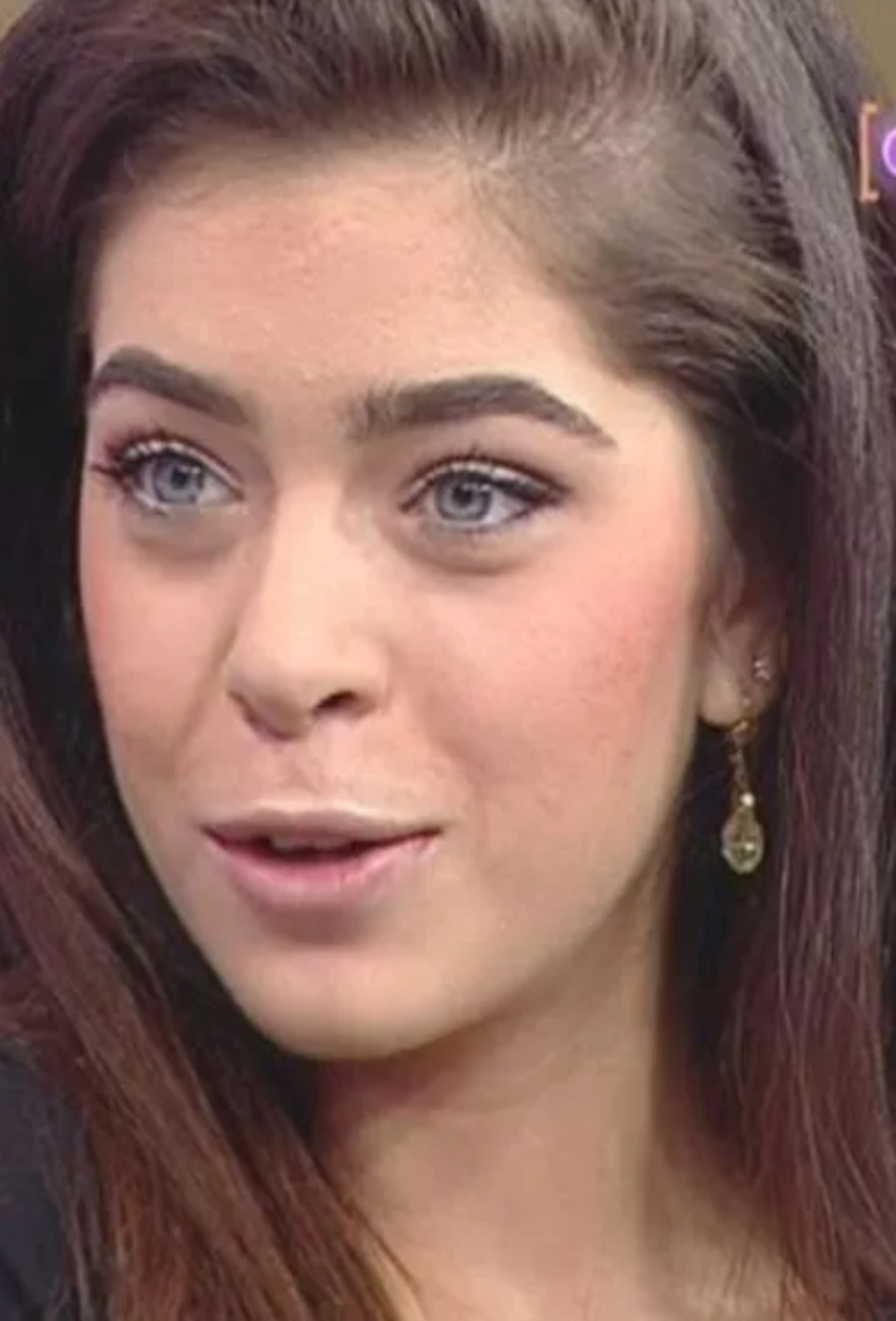 Eski Survivor yarışmacısı Öykü Çelik'in estetiksiz hali şoke etti!