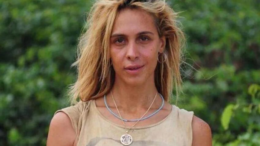 Survivor Duygu Bal'ın son halini gören inanamıyor!
