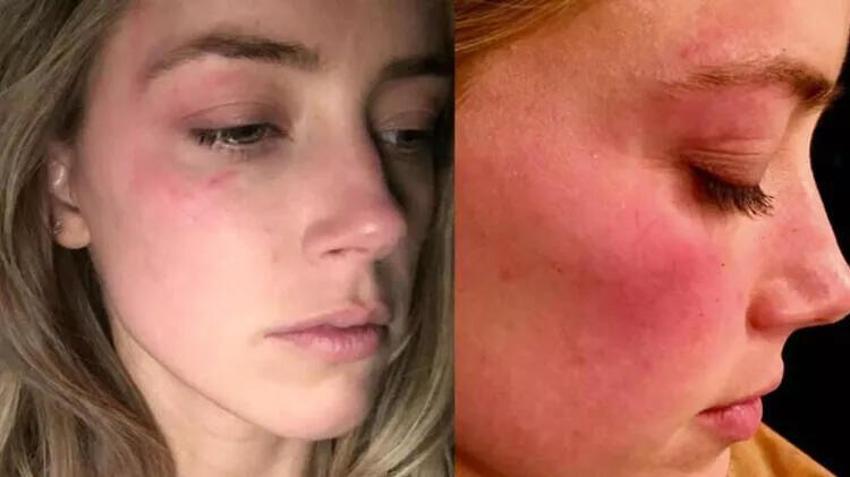 Amber Heard-Johnny Depp davasında karar çıktı! ‘Tehdit’ detayı başını yaktı! Tazminatı nasıl ödeyecek? 