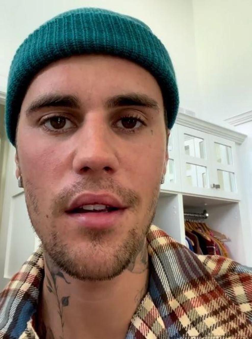 Justin Bieber’dan kötü haber! 'Her şeyi yaptım ama hastalığım giderek kötüleşiyor'