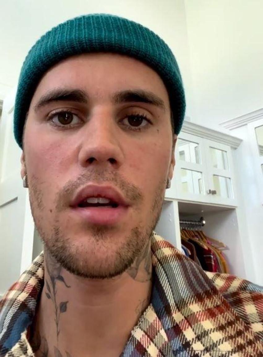 Justin Bieber’dan kötü haber! 'Her şeyi yaptım ama hastalığım giderek kötüleşiyor'