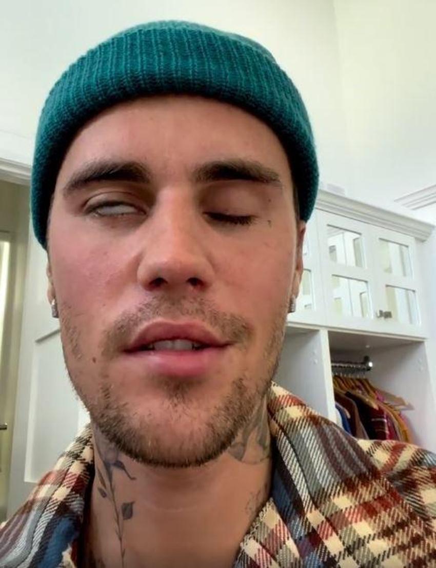 Justin Bieber’dan kötü haber! 'Her şeyi yaptım ama hastalığım giderek kötüleşiyor'