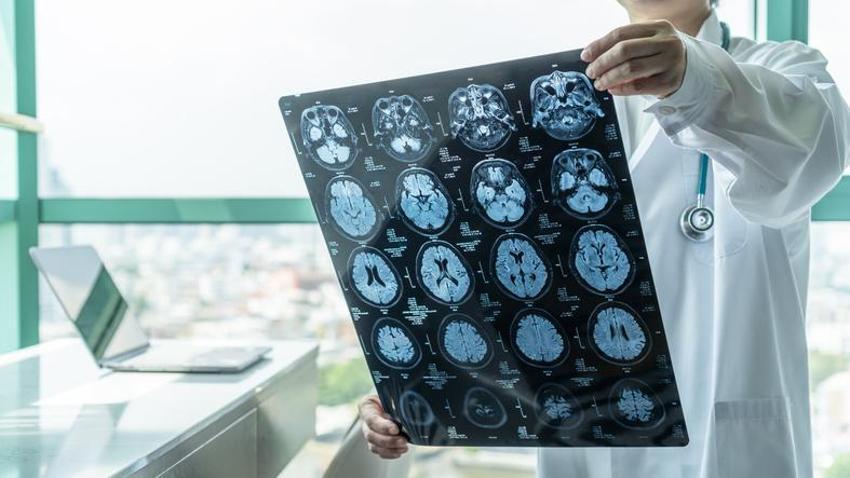 Demans ve Alzheimer ile ilgili korkutan açıklama! Tamamen değişiyor: Araba kullananlar, gülenler, küfür edenler, cömert insanlar...  