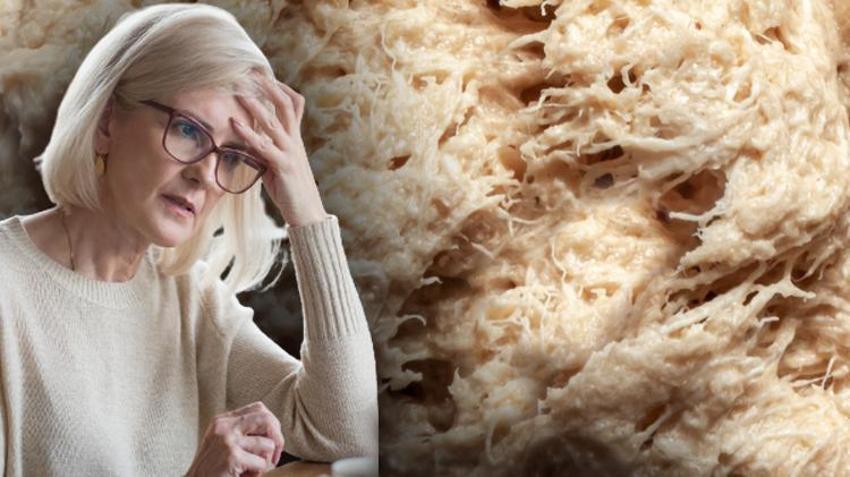 Alzheimer’ı yavaşlatıyor, beyindeki sinir hücrelerini güçlendiriyor! Kolesterolü ve tansiyonu düşürüyor...