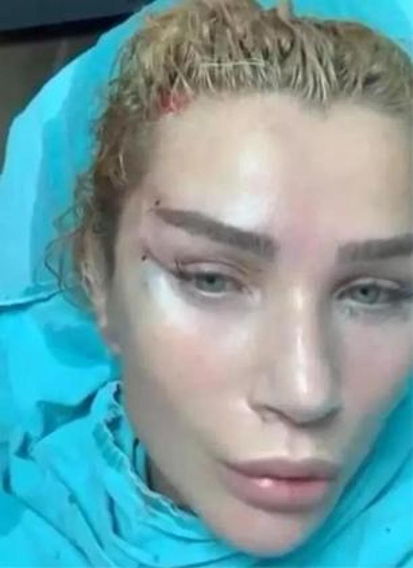 Seda Sayan estetiklere doyamadı! Tatilden döner dönmez...