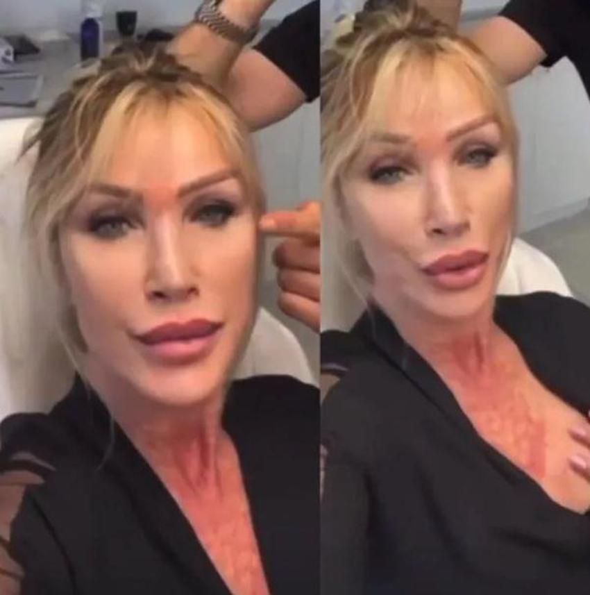 Seda Sayan ve Çağlar Ökten'in son hali dikkat çekti! Yaptırdığı estetiklerle gündem olmuştu