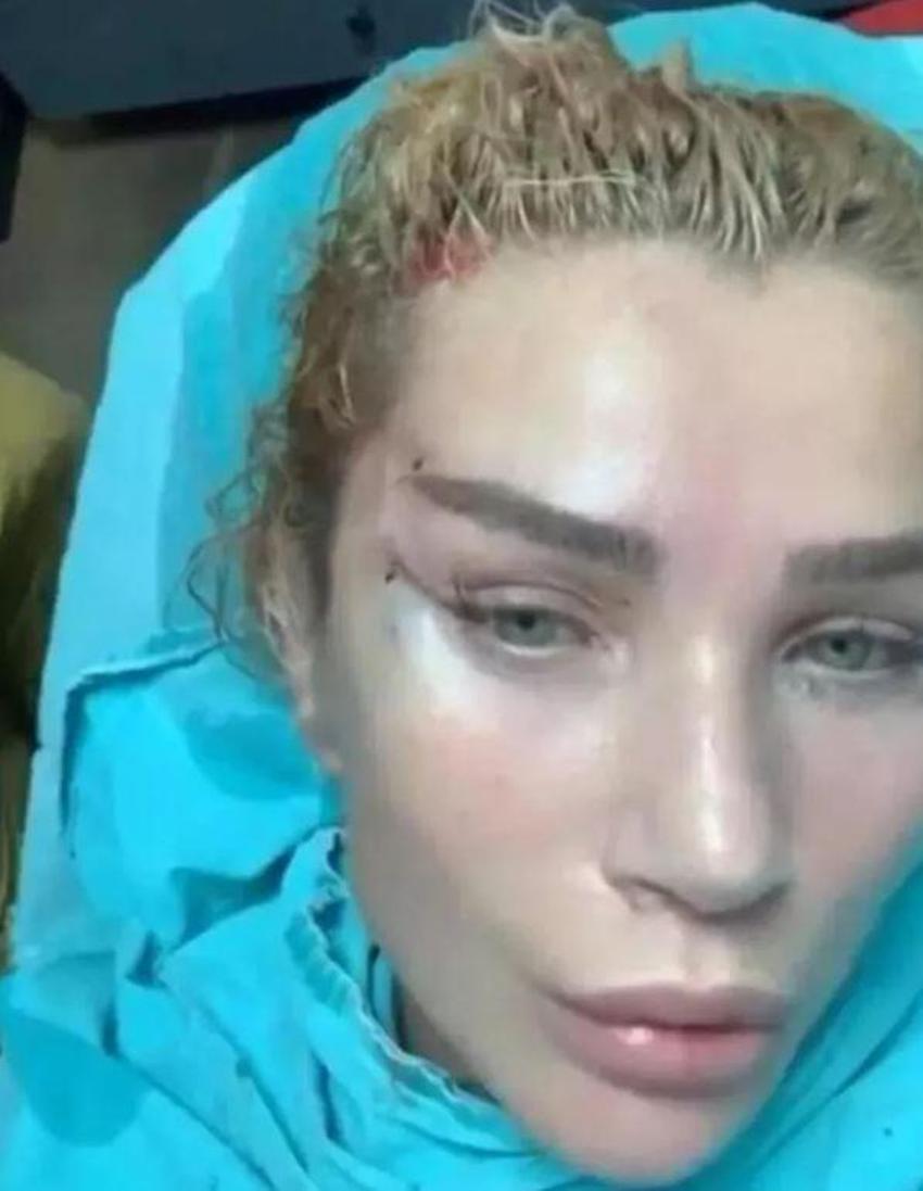 Seda Sayan ve Çağlar Ökten'in son hali dikkat çekti! Yaptırdığı estetiklerle gündem olmuştu