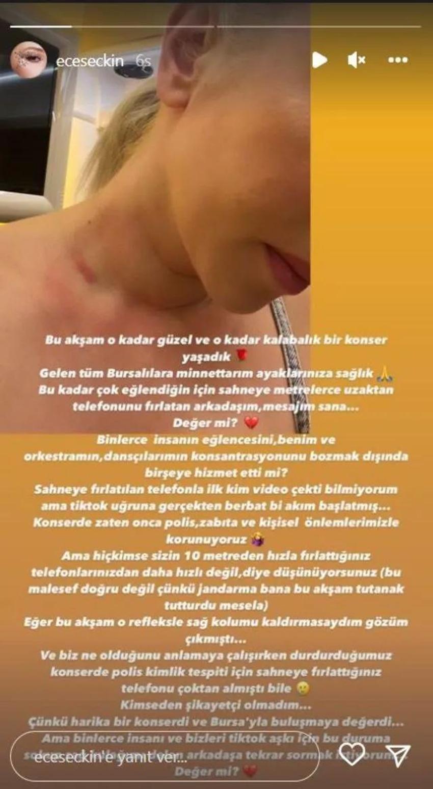 Ece Seçkin'e konser sırasında büyük şok! Çıldırıp isyan etti