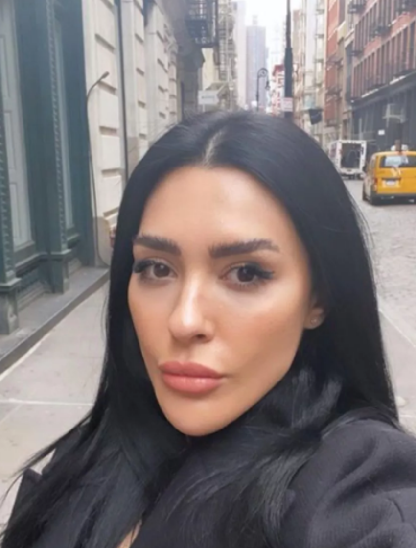 İşte Benim Stilim ile tanınan Ayşegül Melisa Doğan estetik harikası çıktı!