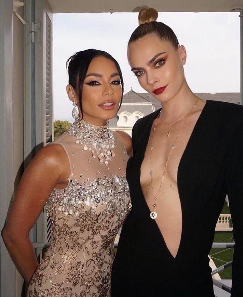 Dünyaca ünlü oyuncu Cara Delevingne'nin korkutan durumu! Akıllara Amy Winehouse geldi