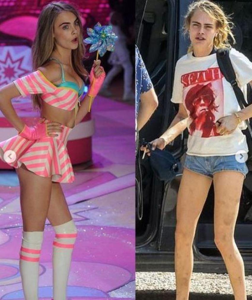 Dünyaca ünlü oyuncu Cara Delevingne'nin korkutan durumu! Akıllara Amy Winehouse geldi