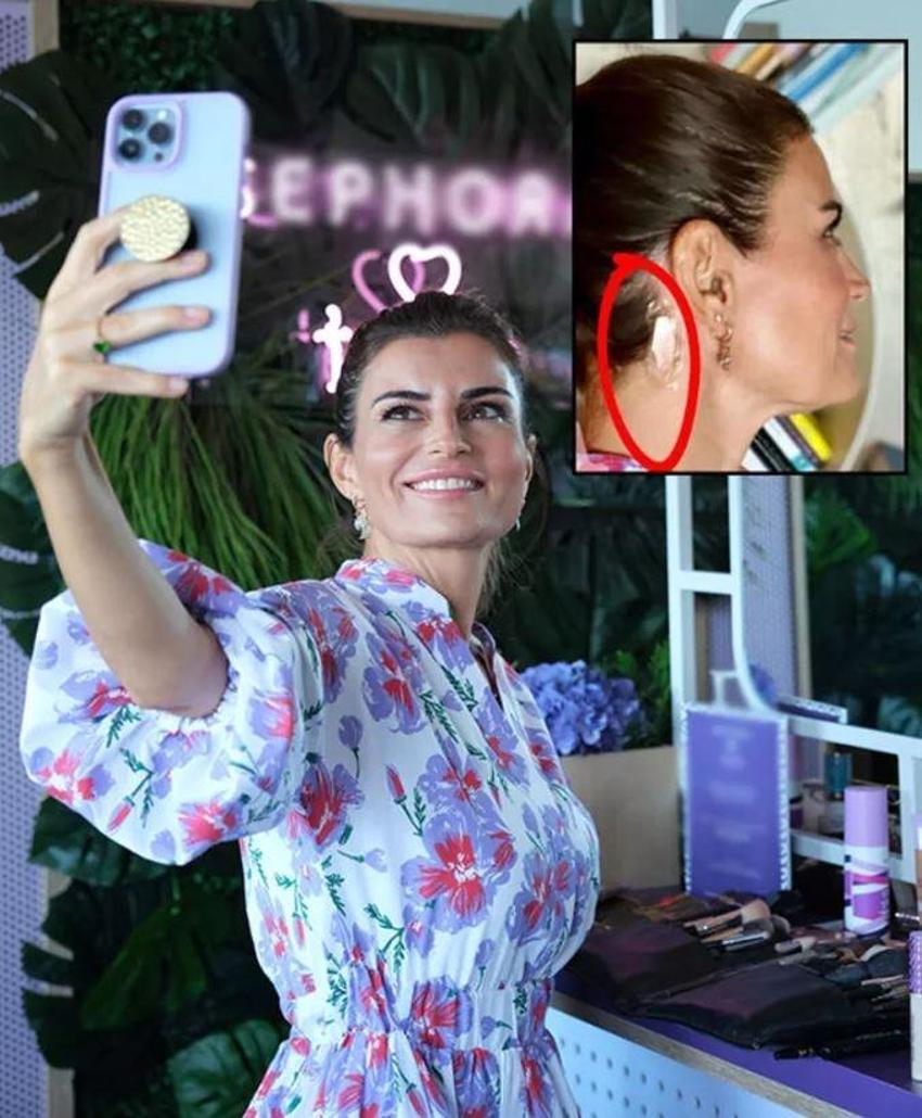 Ece Vahapoğlu davete katıldı, boynundaki izler dikkat çekti! Açıklama yaptı
