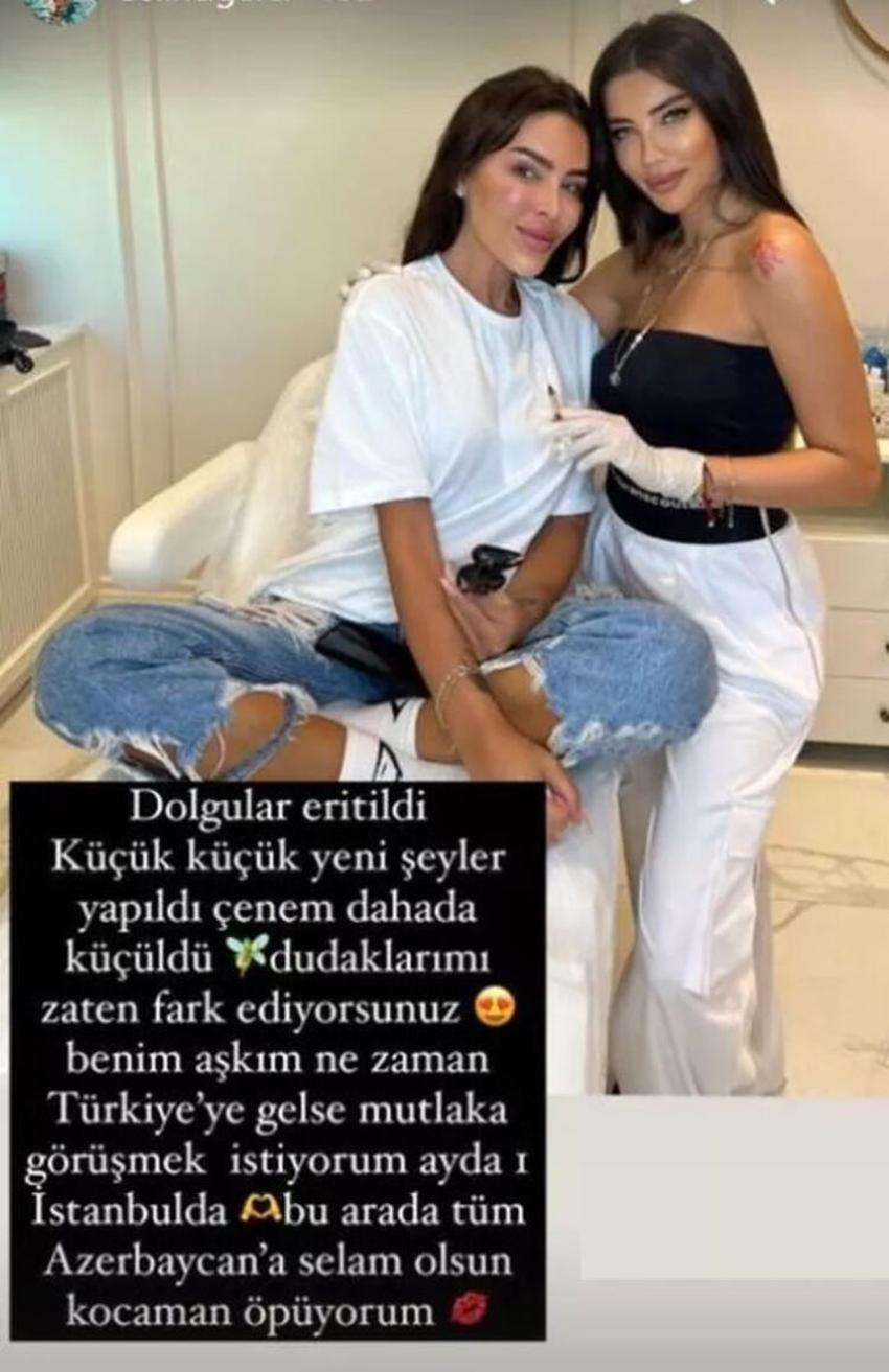Selin Ciğerci'den estetik paylaşımı: Dudaklarımı zaten fark ediyorsunuz