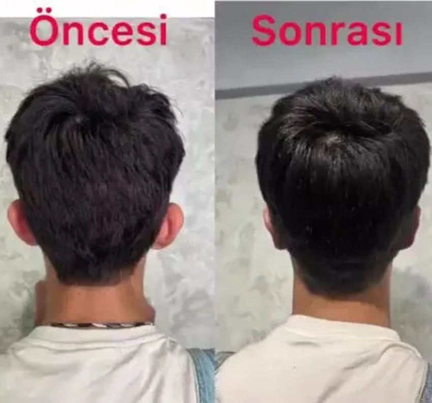 Taha Duymaz'ın estetik pişmanlığı! 'Sürekli kötü yorumlar alıyordum'