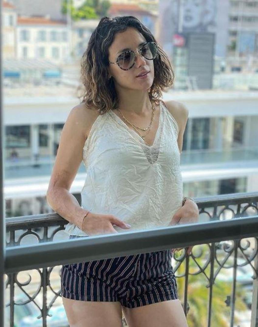 İşte Cansu Tosun'un kolundaki yara izinin hikayesi! Yaşadığı kazayı anlattı
