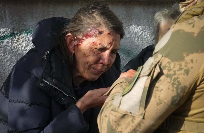 Ukrayna'nın başkenti Kiev'de peş peşe patlamalar! 8 ölü 24 yaralı...