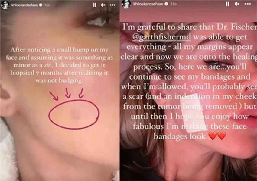 Khloe Kardashian kendisiyle ilgili gerçeği açıkladı!