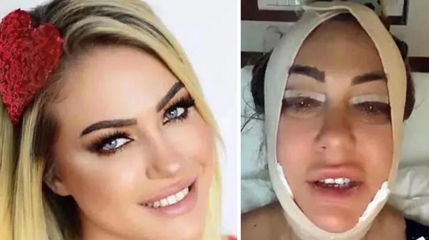 Tuğçe Özbudak'ın yıllar içindeki değişimi şaşırttı! 16 yılda bambaşka biri oldu...
